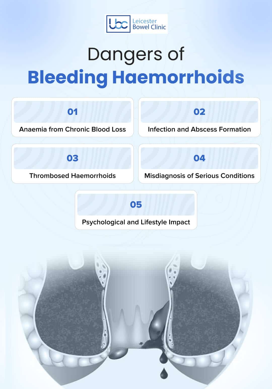 Dangers of Bleeding Haemorrhoids
